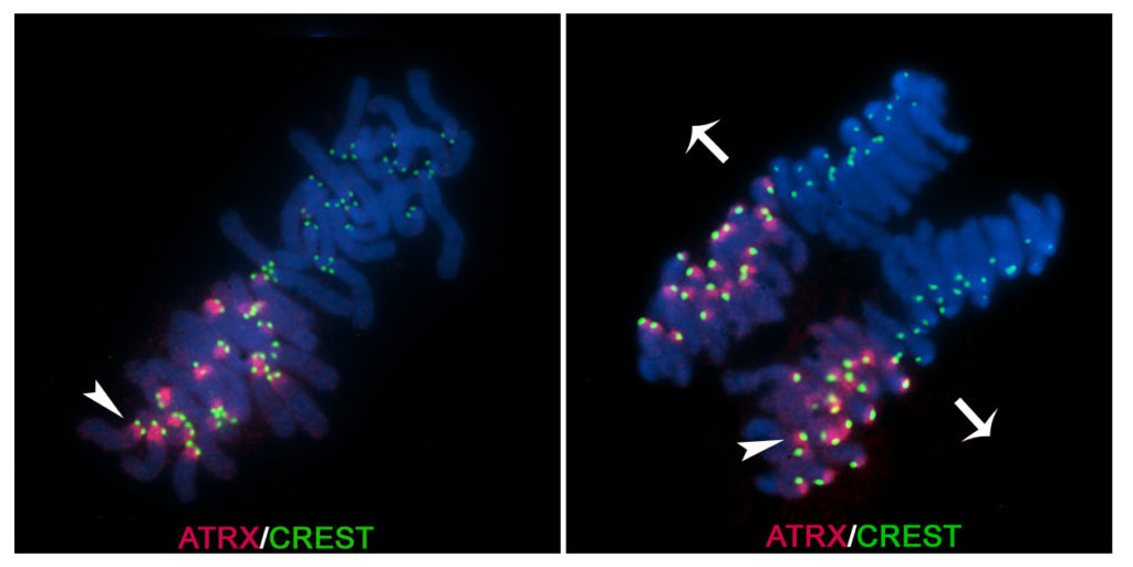 Fluorescence microscopy of maternal paternal chromosomes RBC-h.photo