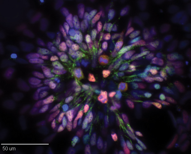 Stice pig iPSC derived NR cells-h.image