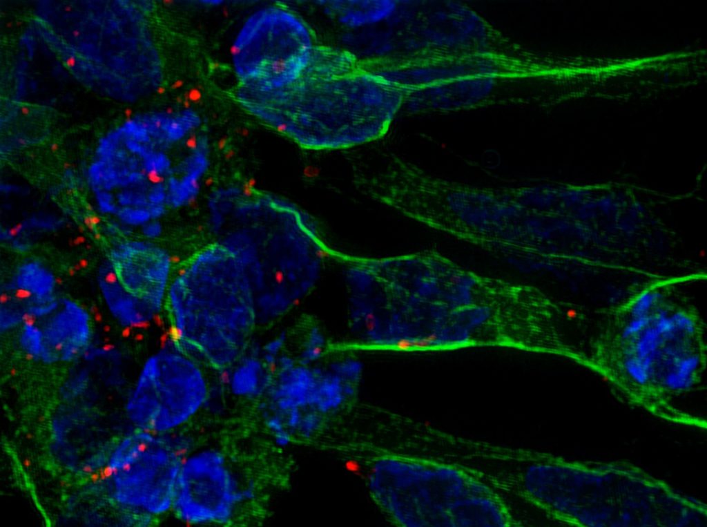 Exosomes under a microscope