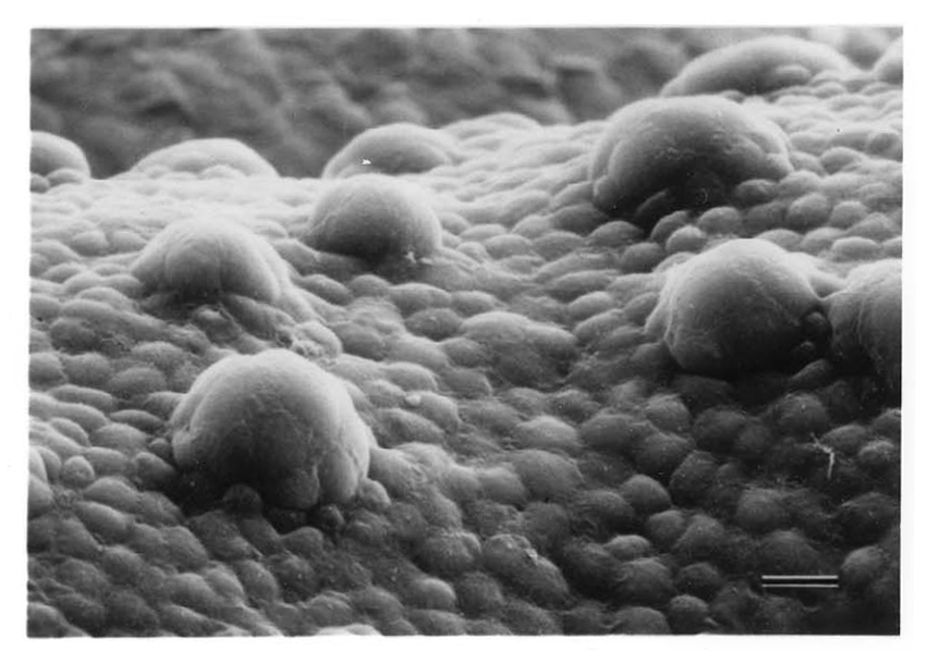 Spiky COVID 19 Particle No Match For Taste Bud Cells