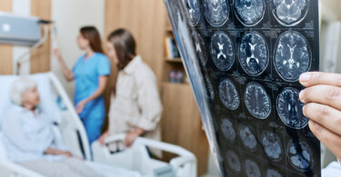 A physician holds a brain scan in the foreground of a photo while a nurse and another woman talks to a patient in their bed.