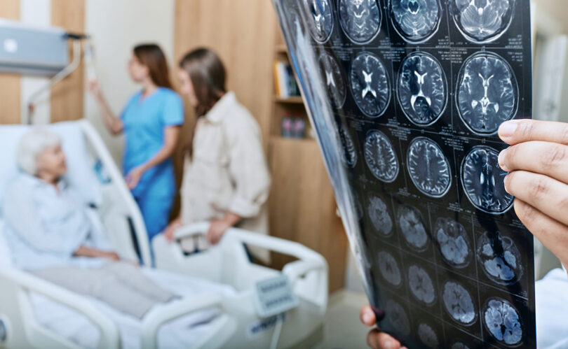 A physician holds a brain scan in the foreground of a photo while a nurse and another woman talks to a patient in their bed.